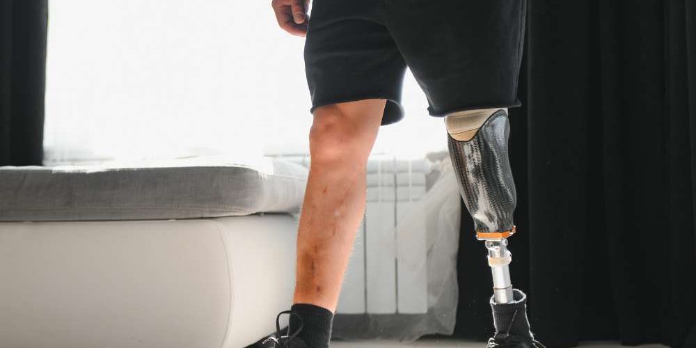 Auxílio no fornecimento de próteses e órteses